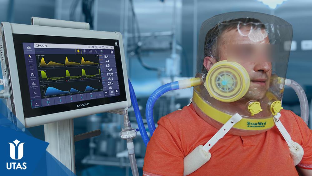 UVENT ICU Ventilators. Non-invasive ventilation with helmet in CPAP/PS mode.