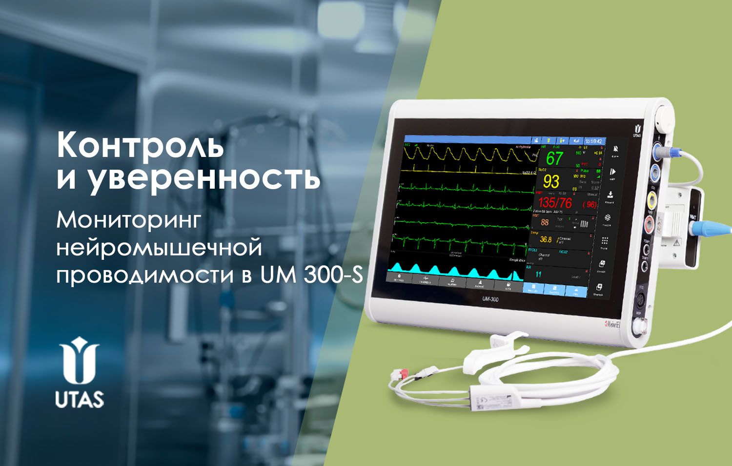 мониторинг нейромышечной проводимости в UM 300-S
